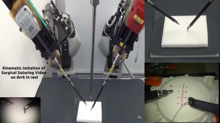Entrenan a un robot con videos de cirugías para que aprenda a suturar heridasEs parte de un proyecto